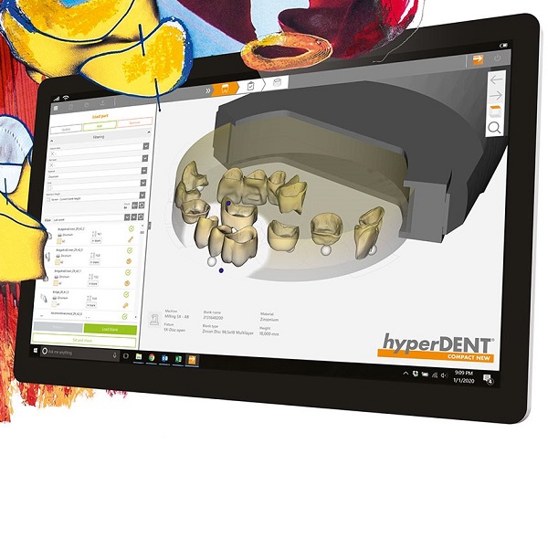 HyperDENT-CAD-CAM-dental-software-image