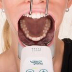 AKOBI DENTAL Foto ogledalo - Image 2