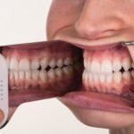 AKOBI DENTAL Foto ogledalo - Image 3