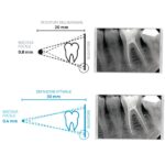NEWTOM RX DC Intraoral X-Ray unit - Image 5